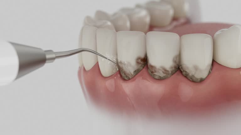 Reliable Teeth Cleaning And Checkup contractor in Cole County County, MO by Dentist Open Now
